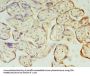 PIH1D1 Antibody