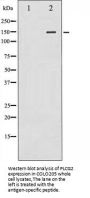 PLCG2 Antibody