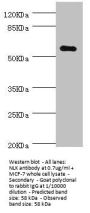 NLK Antibody