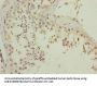 CGGBP1 Antibody