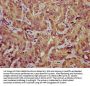 TES Antibody