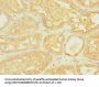 ASIC3 Antibody