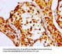 NPC1 Antibody