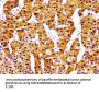 NPC1 Antibody