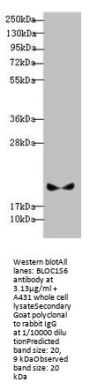 BLOC1S6 Antibody