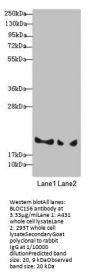 BLOC1S6 Antibody