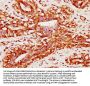 PACSIN2 Antibody