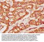 PACSIN2 Antibody