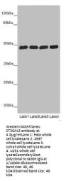 ST3GAL5 Antibody