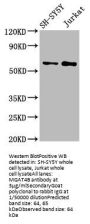 MGAT4B Antibody