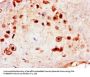 MCM8 Antibody