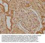 WWC3 Antibody