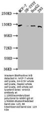 WWC3 Antibody