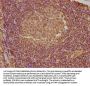 PYCARD Antibody