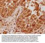PYCARD Antibody