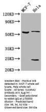 SLC45A2 Antibody