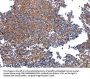 HSPD1 Antibody