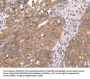 APP Antibody