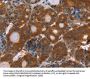 APP Antibody