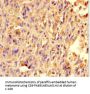 TRAK1 Antibody
