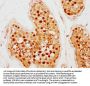 SCML2 Antibody