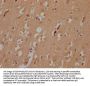 MYO15A Antibody