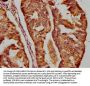 DICER1 Antibody