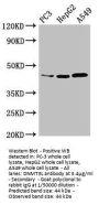DNMT3L Antibody