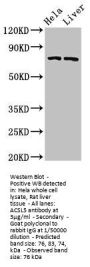 ACSL5 Antibody