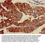 ACSL5 Antibody