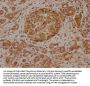 SLC39A10 Antibody