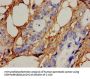 ICK Antibody