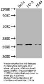 RAB23 Antibody