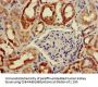 BAIAP2 Antibody