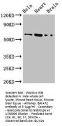 BAIAP2 Antibody