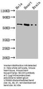 BAIAP2 Antibody