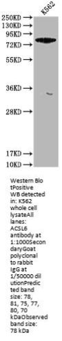 ACSL6 Antibody