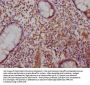 SATB2 Antibody