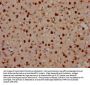 SATB2 Antibody