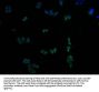 CAMK2A Antibody