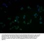 CAMK2A Antibody