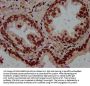 RALY Antibody