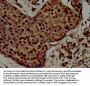 RALY Antibody