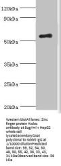IKZF3 Antibody
