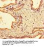 PPM1H Antibody