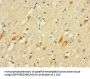 PLCL2 Antibody