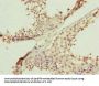FBXL5 Antibody