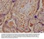 DAPP1 Antibody