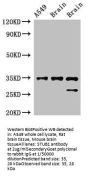 STUB1 Antibody
