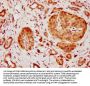 CEP164 Antibody